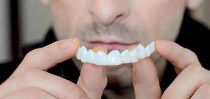 Carillas Dentales Snapon Smile