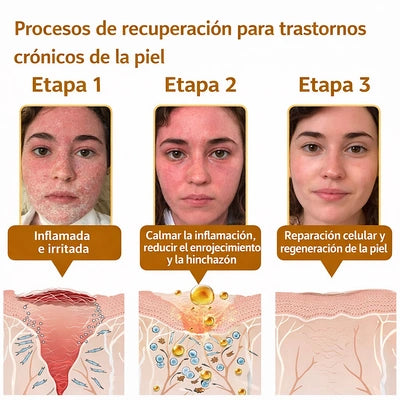 Veneno de Abeja – Crema Facial y Corporal (60g)