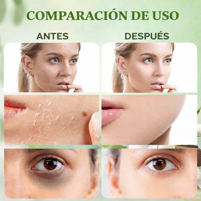 Veneno de Abeja – Crema Facial y Corporal (60g)