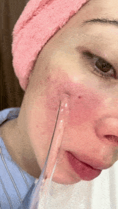 Kit de Alta Frecuencia Portátil 4 en 1 – Piel Limpia, Acné Controlado y Cabello Más Fuerte