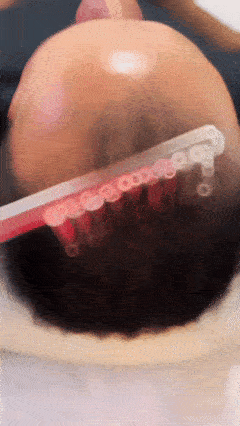 Kit de Alta Frecuencia Portátil 4 en 1 – Piel Limpia, Acné Controlado y Cabello Más Fuerte