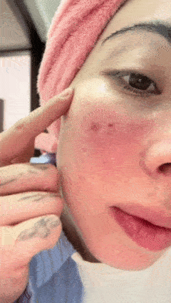 Kit de Alta Frecuencia Portátil 4 en 1 – Piel Limpia, Acné Controlado y Cabello Más Fuerte